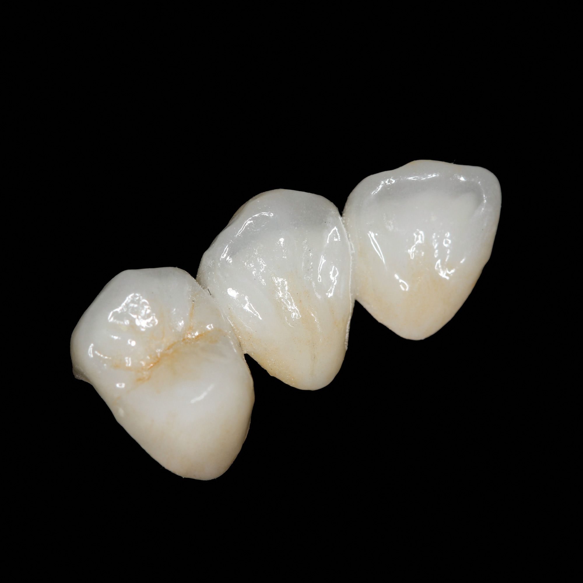 IVADENT LAB - LAYERED-ZIRCONIA-CROWN